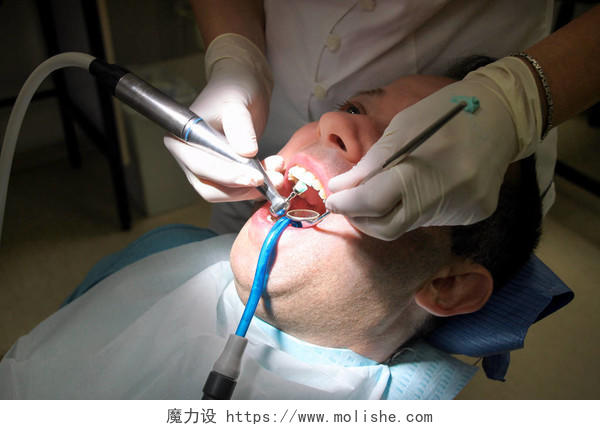 牙科医生在他的牙医诊所和办公室用工具镜软牙刷和口吸管抛光病人牙齿口腔牙齿